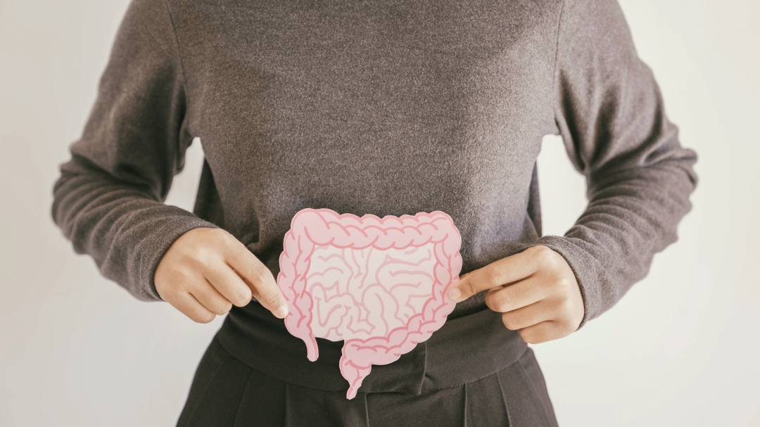 woman holding a colon image to illustrate area for colonoscopy and colon health